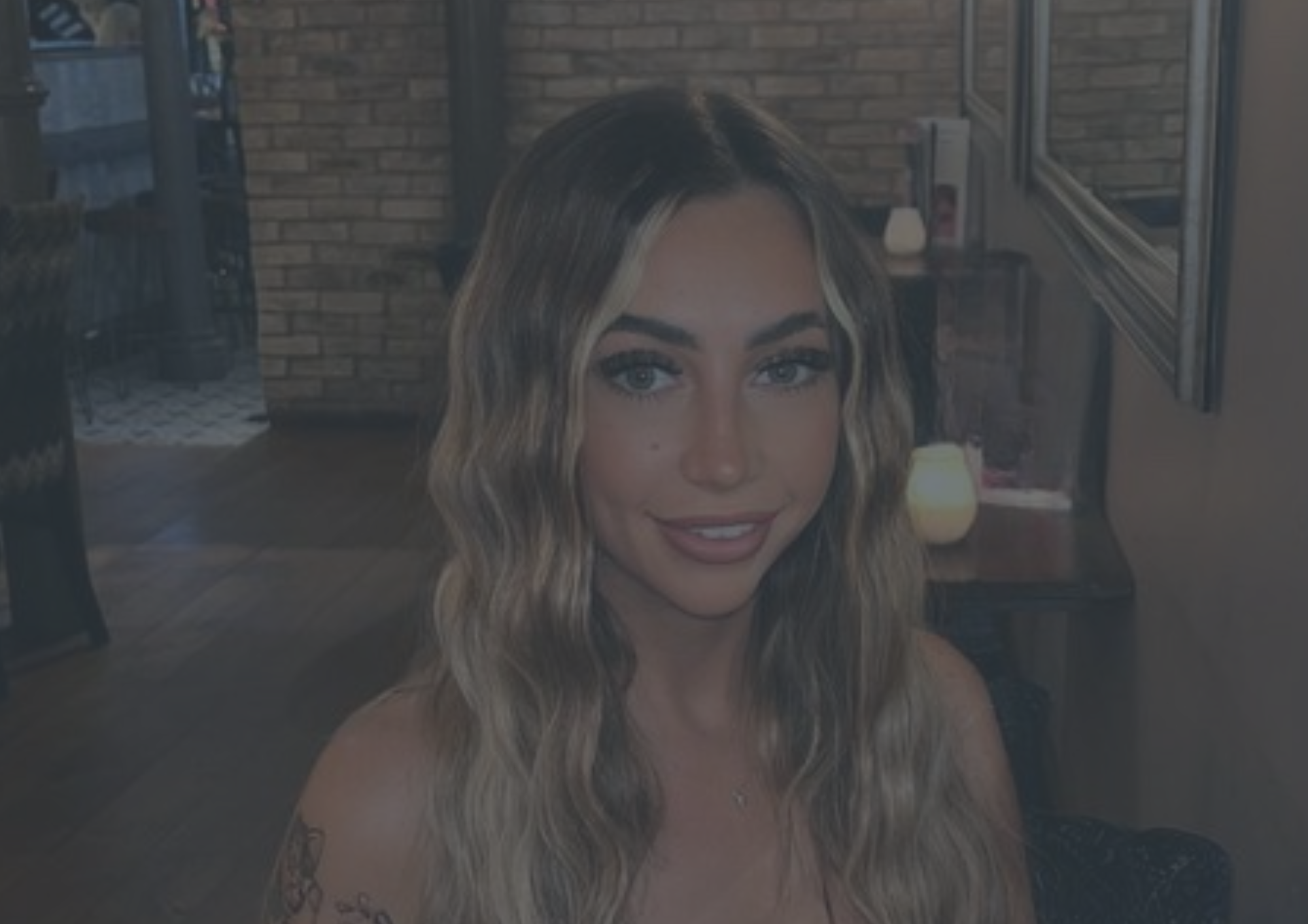 Revision Rhinoplasty Newton-le-Willows Revision Rhinoplasty Newton-le-Willows